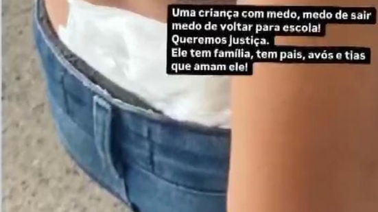 O menino, que tem 11 anos, foi atingido por um disparo nas costas - Foto: Reprodução