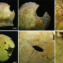 Ossos com marcas de violência extrema - Foto: SCHULTING ET AL. ANTIQUITY, DEZEMBRO DE 2024