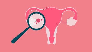 Com sintomas confundidos com outras condições, a endometriose exige acompanhamento especializado (Imagem: Gegambar | Shutterstock)