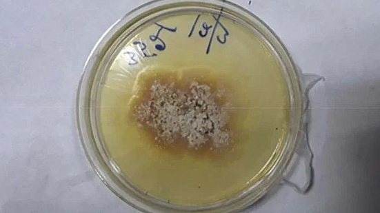 Reprodução/Medical Mycology Case Reports