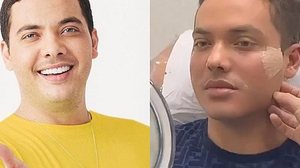 Imagem Wesley Safadão faz harmonização facial: 'Rostinho de bebê'