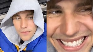 Imagem Justin Bieber mostra recuperação dos movimentos após paralisia facial; assista