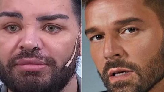 Homem faz mais de 30 cirurgias plásticas para se parecer com Ricky Martin | Foto: Reprodução