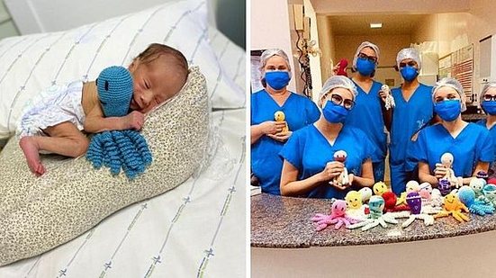 Imagem Mulheres criam ‘polvinhos de crochê’ e doam a bebês prematuros internados em hospital de AL