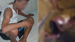 O homem foi espancado após suspeita de assalto em Maceió | Montagem TNH1