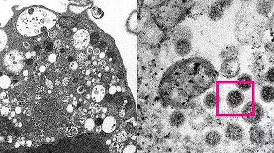 magem destaca variante ômicron do coronavírus feita com um microscópio | Foto: Faculdade de Medicina da Universidade de Hong Kong / Cortesia