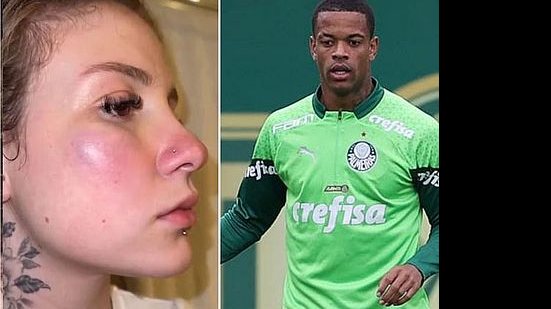 Ana Clara mostra hematomas e denuncia o jogador Caio Paulista | Montagem