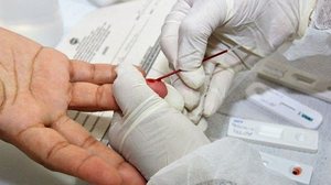 Sesau lança campanha para estímulo à testagem rápida de HIV | Carla Cleto