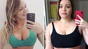 Ex-BBB reproduziu antes e depois no Instagram | Instagram