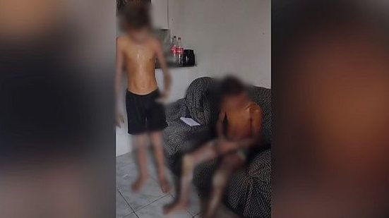 Imagem Vídeo: explosão de pólvora deixa irmãos feridos em Ibateguara