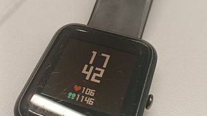 Imagem Smartwatches não devem ser usados para medir glicose, diz Anvisa