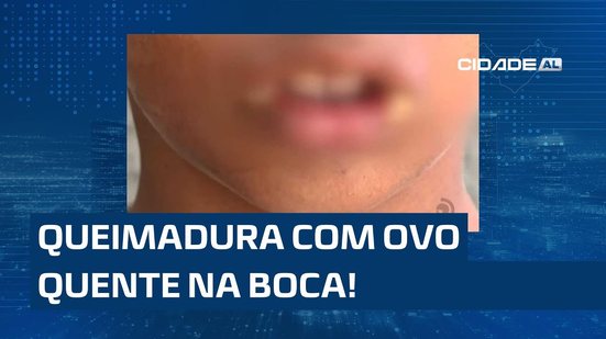 Ovo Quente na Boca: Criança segue internada e será levada para abrigo; avó e marido foram liberados