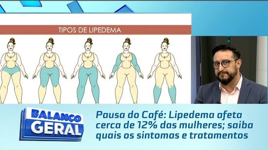 Pausa do Café: Lipedema afeta cerca de 12% das mulheres; saiba quais os sintomas e tratamentos