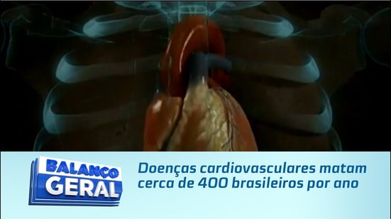 Doenças cardiovasculares matam cerca de 400 brasileiros por ano