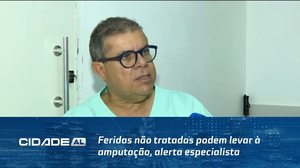 Feridas não tratadas podem levar à amputação, alerta especialista